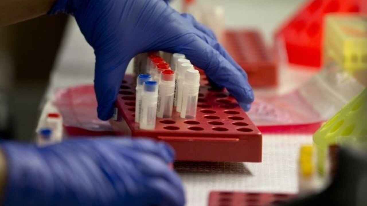 lieky liečba nemocnica medicína choroba vakcína skúmavky skúmavka doktor lekár krv (SITA)